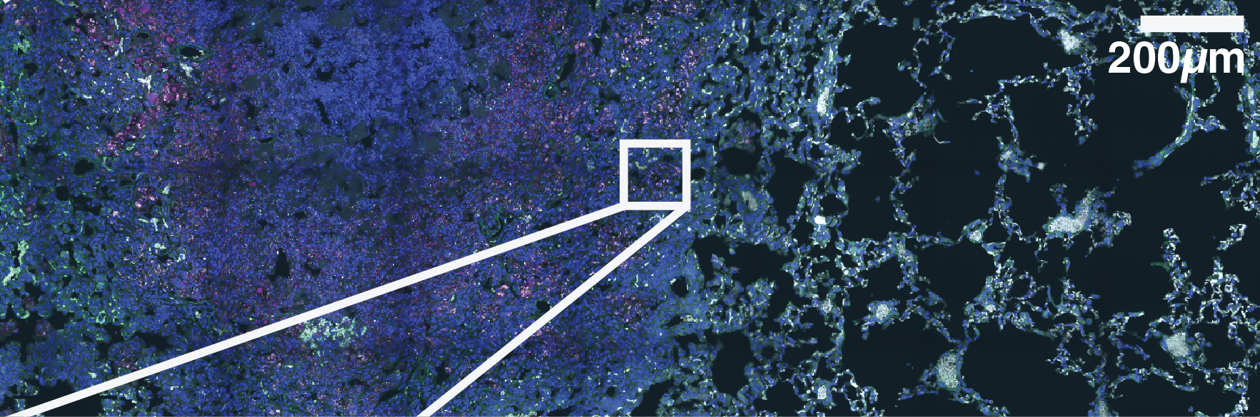 Supplementary Figure S8B zoomed lung section